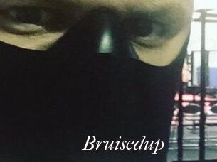 Bruisedup